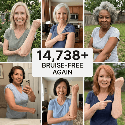 💥Over 100,000 units sold💕 - Bruise Cream to repair bruises and strengthen the skin 💥Over 100,000 units sold💕 - Bruise Cream to repair bruises and strengthen the skin